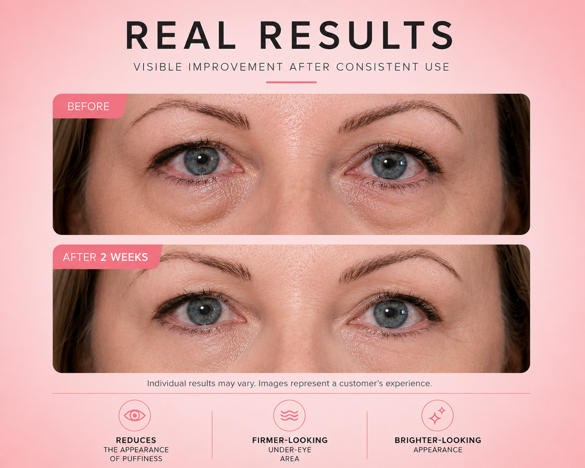 Avora EyeRevive™