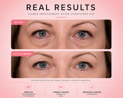 Avora EyeRevive™